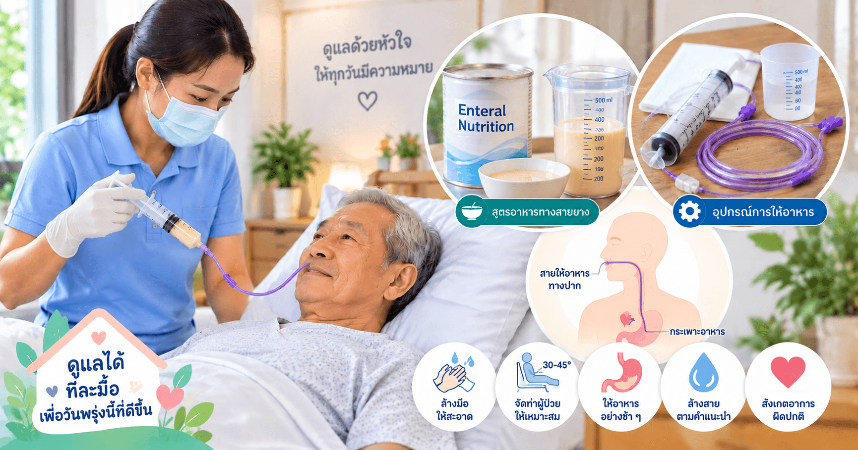 ให้อาหารทางสายยางอย่างปลอดภัยสำหรับผู้ดูแลมือใหม่
